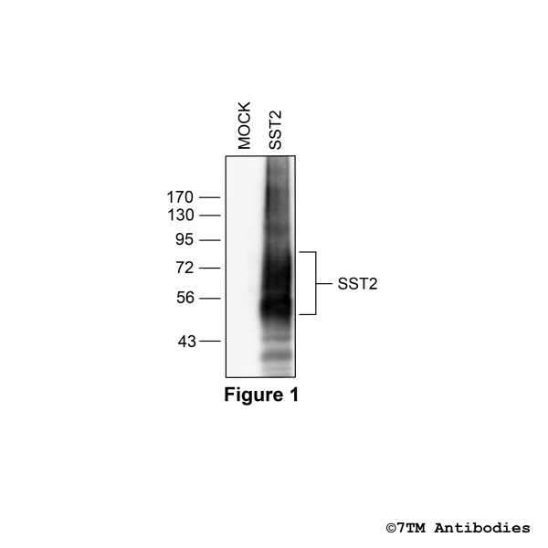 SST2 (non-phospho), Somatostatin Receptor 2 Antibody