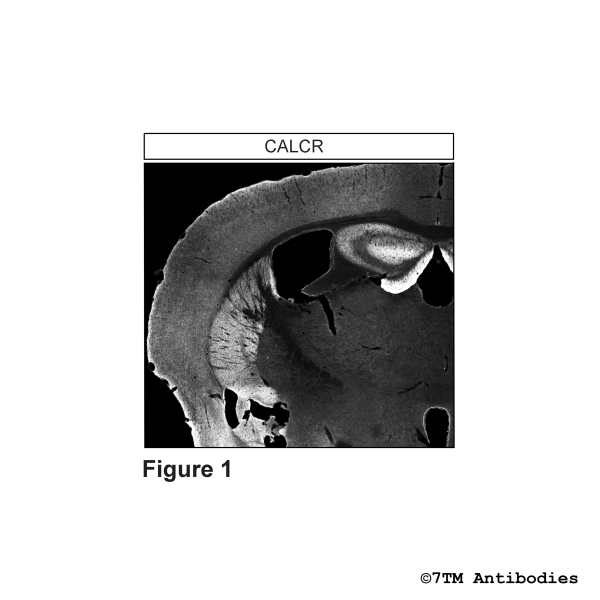 CALCR (IHC-grade) Calcitonin Receptor-Like Receptor Antibody