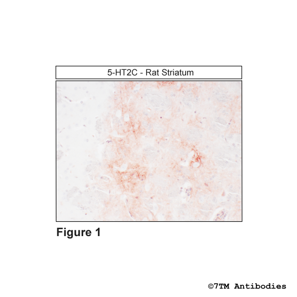Immunohistochemical varification of 5-Hydroxytryptamine Receptor 2C antibody in Rat Striatum