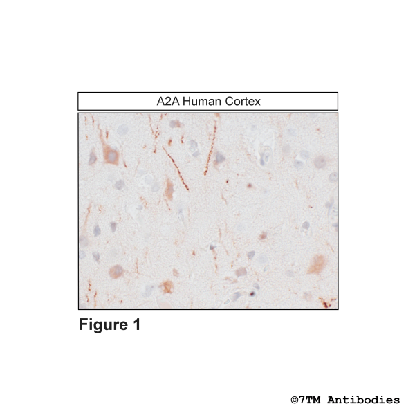 Immunohistochemical identification of the A2A Adenosine Receptor in human cortex