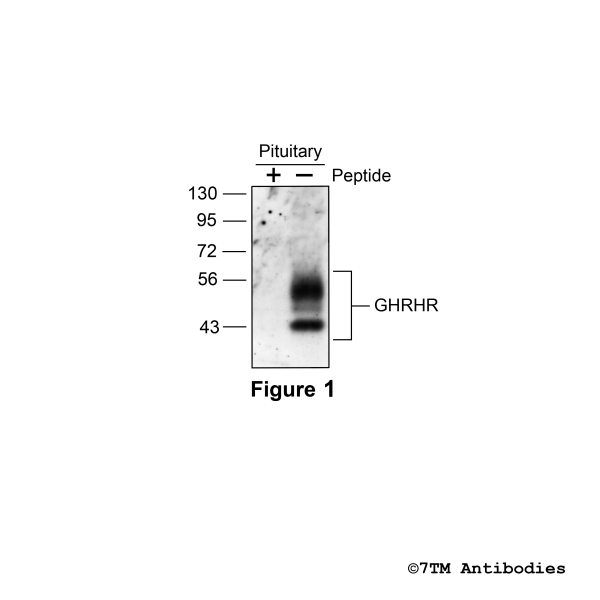 Validation of the Growth Hormone-Releasing Hormone Receptor in pituitary adenoma.