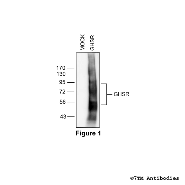 Validation of the Ghrelin Receptor in transfected HEK293 cells