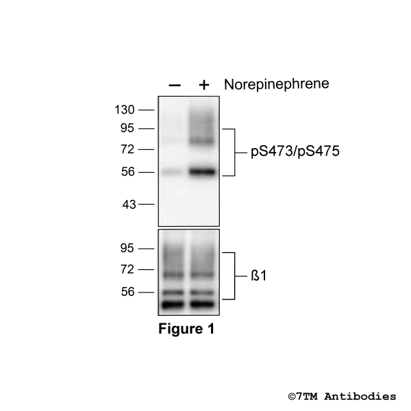pS473/pS475-β1 (phospho-β1-Adrenoceptor Antibody)