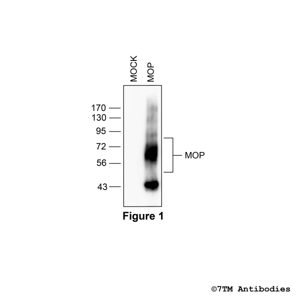 MOP (non-phospho), µ-Opioid Receptor Antibody