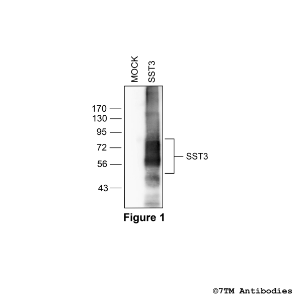 SST3 (non-phospho), Somatostatin Receptor 3 Antibody