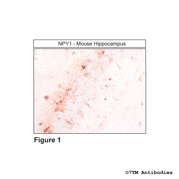 Immunohistochemical identification of Neuropeptide Y Receptor 1 in mouse hippocampus