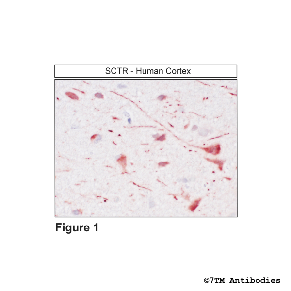 Immunohistochemical identification of Secretin Receptor in human cortex