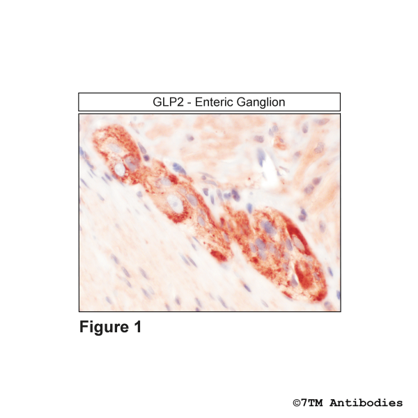 Immunohistochemical identification of Glucagon-Like Peptide 2 Receptor in enteric ganglion