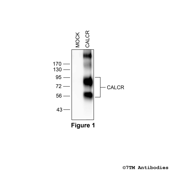 Validation of the Calcitonin Receptor-Like Receptor in transfected HEK293 cells