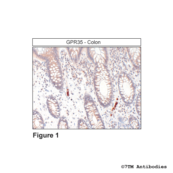 Immunohistochemical identification of GPR35 Receptor in human colon
