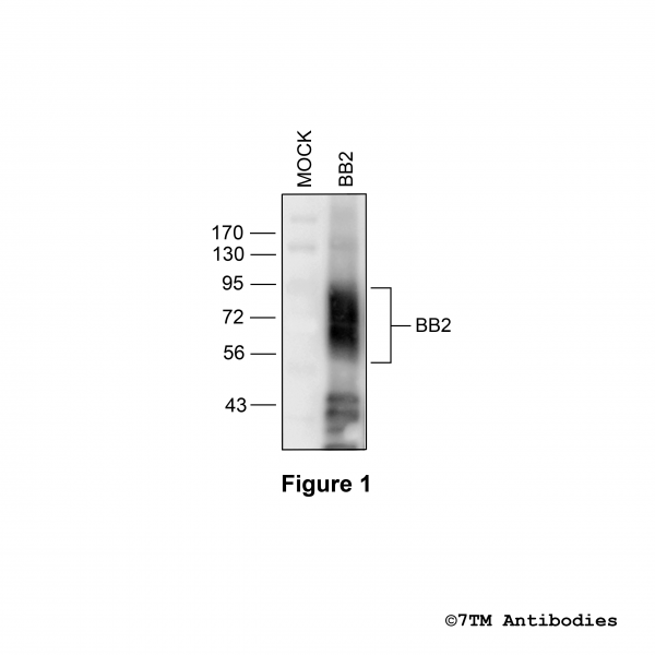 Validation of the Bombesin Receptor 2 in transfected HEK293 cells